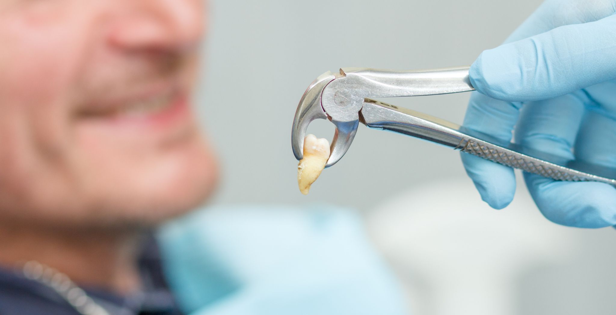 Wisdom tooth extraction, Wisdom teeth removal, Wisdom tooth surgery, Impacted wisdom tooth extraction, Wisdom tooth removal procedure, Dental extraction for wisdom teeth, Oral surgery for wisdom teeth,